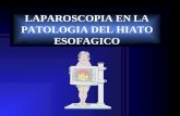 LAPAROSCOPIA EN LA PATOLOGIA DEL HIATO ESOFAGICO
