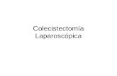 Colecistectomía Laparoscópica