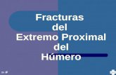Fracturas  del  Extremo Proximal  del  Húmero