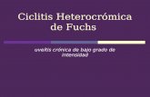 Ciclitis Heterocrómica  de  Fuchs