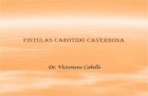 Fístula Carótido Cavernosa