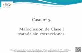 5.- Maloclusión de Clase I tratada sin extracciones - Rafael Gallardo Galdón