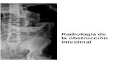 Radiología de La Obstrucción Intestinal
