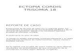Ectopia Cordis Trisomia 18