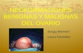 NEOFORMACIONES BENIGNAS Y MALIGNAS DEL OVARIO Sergio Marmori Laura Gonzalez.
