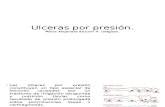 Ulceras por presion