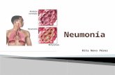 Neumonia Practicas