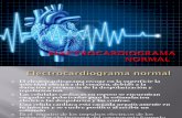 Electrocardiogram A