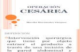 Cesarea Exposicion