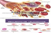 Laboratorio Clínico - Alteración de Los Leucocitos