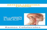 Arteria Carotida Externa y Venas