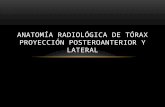 Anatomía Radiológica de Tórax