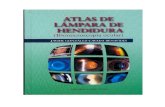 Atlas de Lampara de Hendidura (Biomicroscopia Ocular)