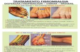 Tratamiento de Fibromialgia