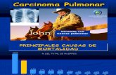 Carcinoma Pulmonar.1