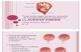 3 Placenta Previa
