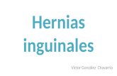 Hernias inguinales