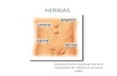 Hernias abdominales, hernia femoral hernia inguinal