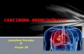 Tratamiento del carcinoma broncogénico