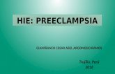 Hipertensión inducida por el embarazo: PREECLAMPSIA