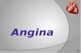 angina presentation