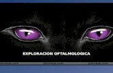 Exploracion oftalmolgica