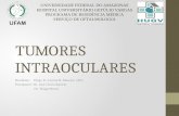 Tomores intraoculares