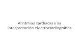 Arritmias cardíacas-y-su-interpretación-electrocardiográfica