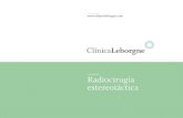 Radiocirugía estereotáctica