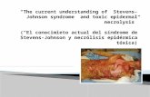 “El conocimieto actual del síndrome de Stevens-Johnson y necrólisis epidérmica tóxica