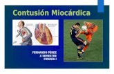 Contusion miocardica