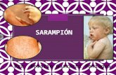 Presentacion de la enfermedad del Sarampion