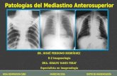 Patologías del mediastino anterosuperior en Imagenología