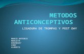 Metodos anticonceptivos ligadura y postday