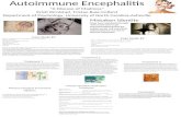 Autoimmune Encephalitis Presentation