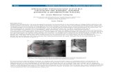 Ultrasonido Intravascular (I.V.U.S.): Lecciones del pasado, utilidad ...