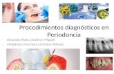 Procedimientos diagnósticos en periodoncia