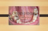 Caries dental115