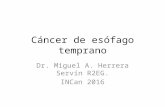 Detección y manejo endoscópico del cancer de esófago temprano