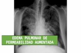 Edema pulmonar de permeabilidad aumentada