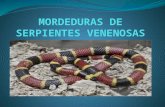 Mordeduras de serpientes venenosas