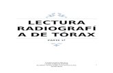 (2016.03.29) Lectura de Radiografía de Tórax (Parte 1) (DOC)
