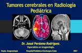 Tumores cerebrales en radiología pediátrica. Diagnóstico Imagenológico.
