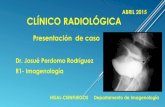 Fístula colo-vesical. Imagenología Clinico radiológica.