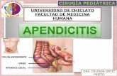 Exposicion apendicitis