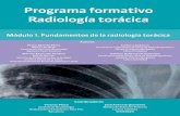 Programa formativo Radiología torá · PDF fileAnatomía para la interpretación de la radiologia de torax ... en la lectura de ambas técnicas. ... Distribución del lóbulo medio