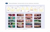 1 Generalidades: restauración de los dientes naturalesmedia.axon.es/pdf/98238_1.pdf · base para la restauración de caries. Mientras que, ... colos menos invasivos como el blanqueamiento