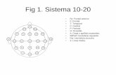 Fig 1. Sistema 10-20anestesiar.org/WP/uploads/2012/09/EEG-Figuras.pdf · Ritmo Theta en región parietal derecha a 5 Hz. Fig 5. ... Actividad Delta polimórfica frontoteporal izquierda.