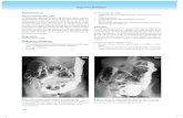 RESPUESTA 53 Observaciones (53a, 53b) La radiografía ... · PDF filedel colon más distal hace la enfermedad de Crohn más probable que la colitis ulcerativa. Es de notar que las
