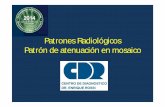 Patrones Radiológicos Patrón de atenuación en mosaicocongreso.sordic.org.ar/uploads/2014/residentes/2014_119_Torax.pdf · Patrones Radiológicos Patrón de atenuación en mosaico.